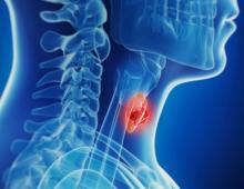 Лечение рака щитовидной железы – основные методики